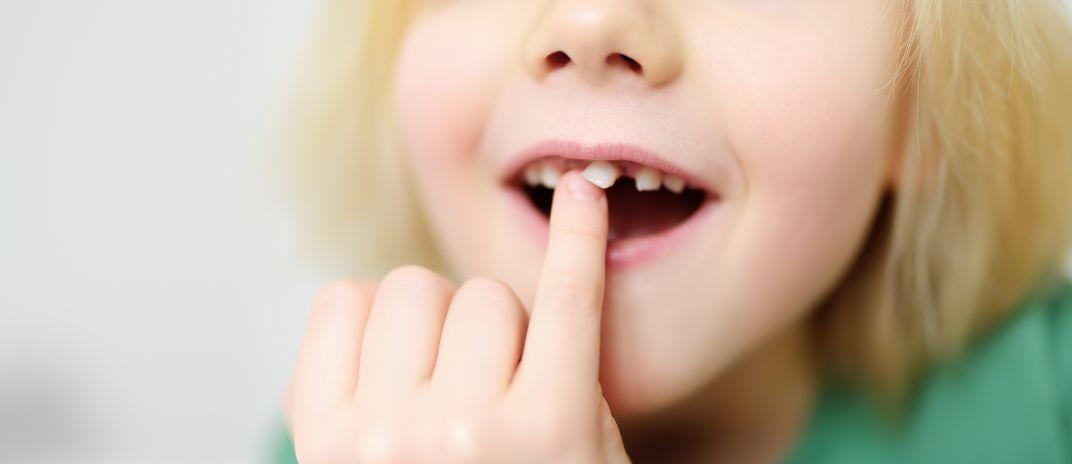 Dream About Teeth Falling out - what does it mean and how to interpret?