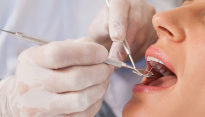 What Does it Mean If You Dream About Losing Teeth?